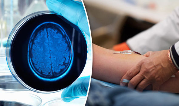 Alzheimers CURE: ‘Vampire’ blood therapy to help BEAT dementia